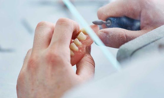 Individuelle Prothetik - Praxis für Zahnheilkunde Dr. Maximilian Grimm und Zahnärztin Eva Krieger
